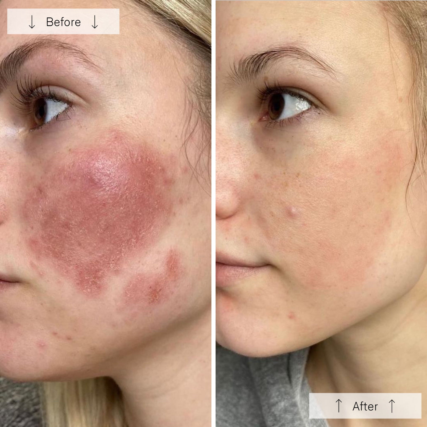 Omnilux Contour Face