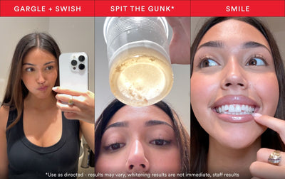iD Stain Whitening Mouthwash