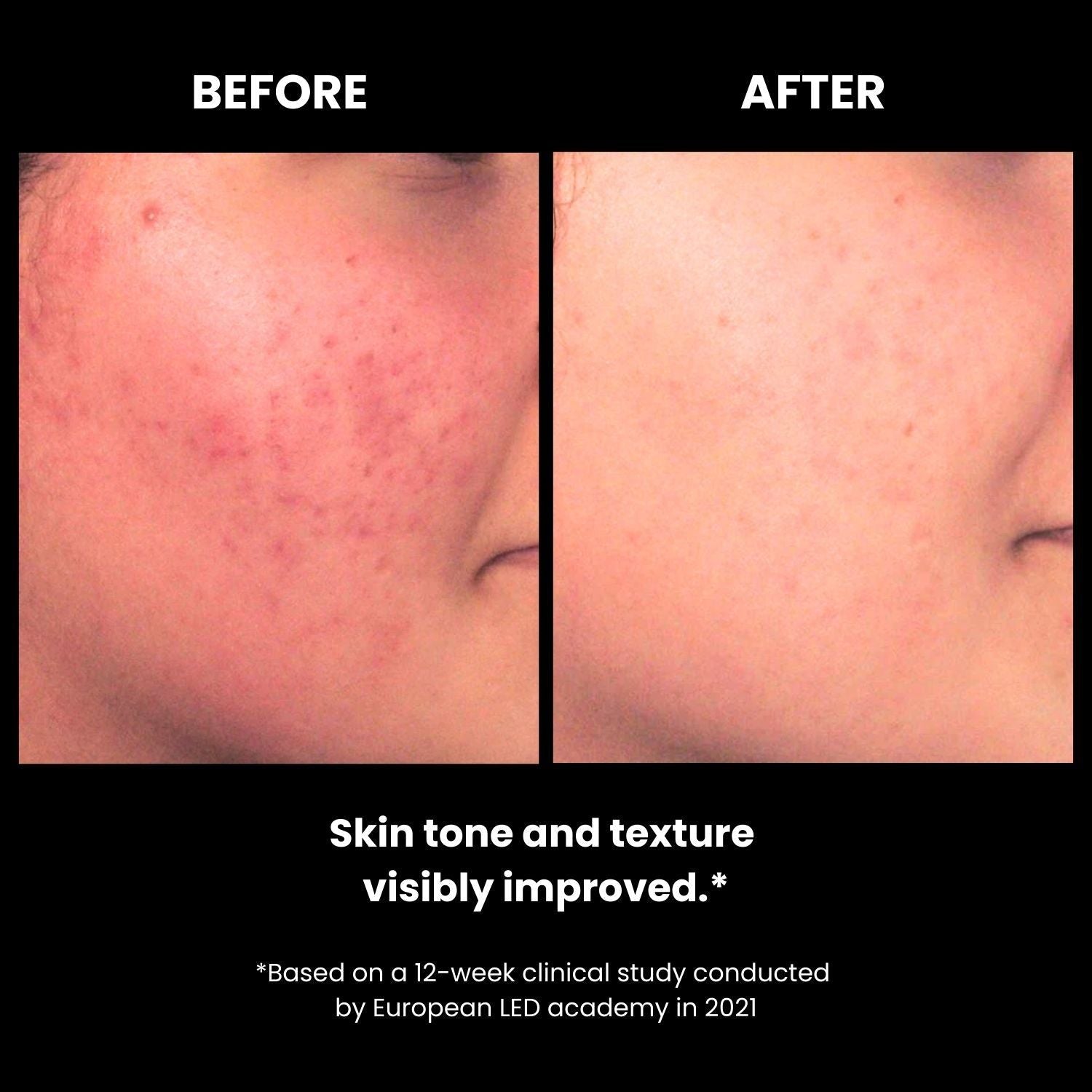 LUSTRE SOLO